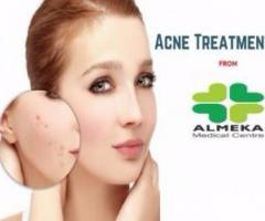 Acne Pimples Treatment Kerala