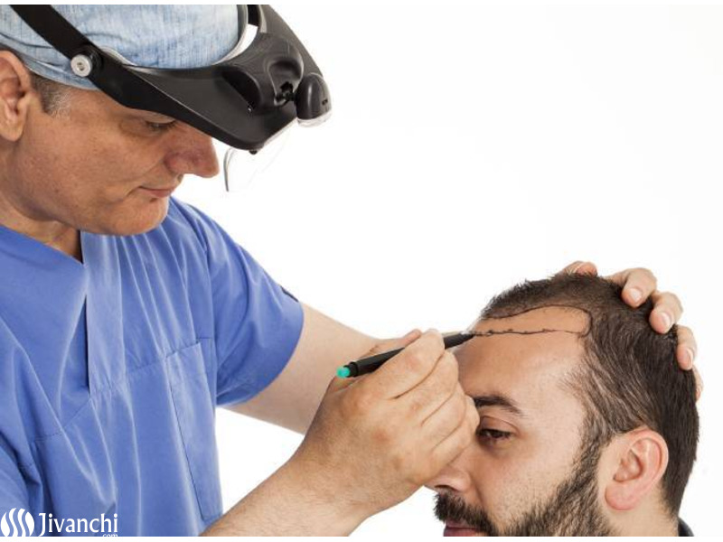 Top Hair Transplant Clinic in Hyderabad | Hair Clinic in Hyderabad - 1