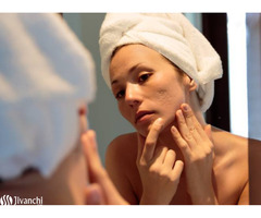 ACNE Treatment and Scar Removal Treatment in Hyderabad - Pelle Clinic - Image 2