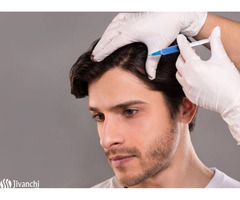 Treatment for Hair Loss - Pelle Clinics