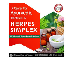 Bhagwati Ayurved Herpes Simplex Ayurvedic Medicine