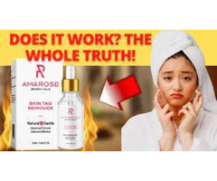 Indroduction Of Amarose Skin Tag Remover
