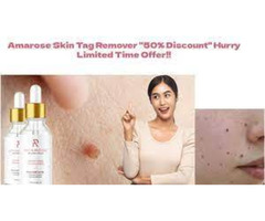 Purchasing Amarose Skin Tag Remover