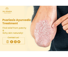 Renowned Clinic in Ludhiana for Psoriasis Ayurvedic Treatment | Dr. Sharda Ayurveda