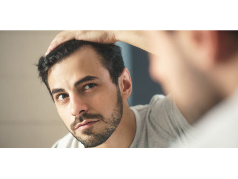 Effective Hair Loss Treatment in Bangalore - 1