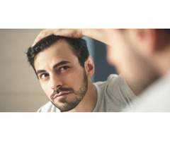 Effective Hair Loss Treatment in Bangalore