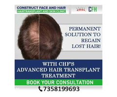 Best Hair Transplant in Chennai