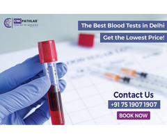 The Best Blood Tests in Delhi: Get the Lowest Price!