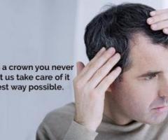 Get The Guaranteed Hair Transplant At Lowest Price, Kochi