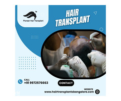 Affordable Hair Transplant Clinics in Bangalore with Pioneer Hair Transplant