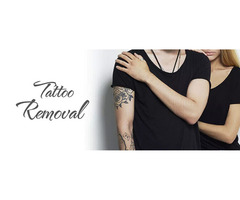 Tattoo Removal Center in Bangalore-Tattoo Removal Cream