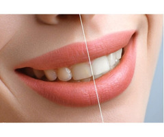 Smile Designing in Mumbai at Smile Again Dental Clinic