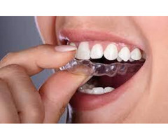 Invisalign Treatment in Mumbai at Smile Again Dental Clinic