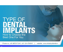Dental Implants in Gurgaon - MOS - Image 2