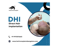 DHT Hair Transplant Bangalore | DHI Hair Transplant Cost - Image 2