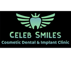 Celeb Smiles Dental Clinic - Orthodontist in Hinjewadi | Dental Clinic In Hinjewadi | Aligners, Brac