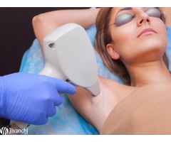 Laser Hair Removal In Delhi
