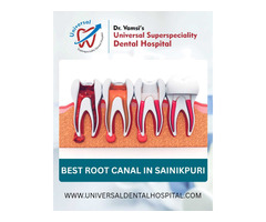 Top Reasons to Choose a Root Canal Specialist Over a General Dentist