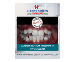 Guided Biofilm Therapy in Hyderabad