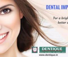 Dental Implants To Regain Your Confidence