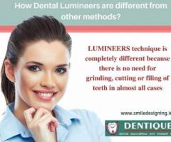 Achieve A Perfect Smile With Dental Lumineers