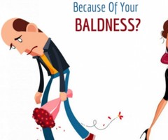 Get Your Younger Days Back With Hair Transplantation