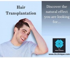 Get Your Younger Days Back With Hair Transplantation - Image 2