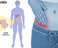 Treat Your Appendicitis Effectively In Cochin