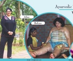 Lose weight naturally with Kairali Ayurvedic Healing Village