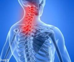Eliminate Your Neck Pain - Affordable Treatments In Kochi - Image 3