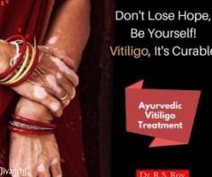 Get Faster Recovery From Vitiligo With Ayurveda
