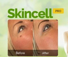 Does Skincell pro mole and skin tag remover work?