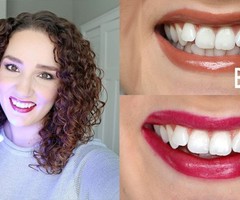 http://www.health4welness.com/snow-teeth-whitening/